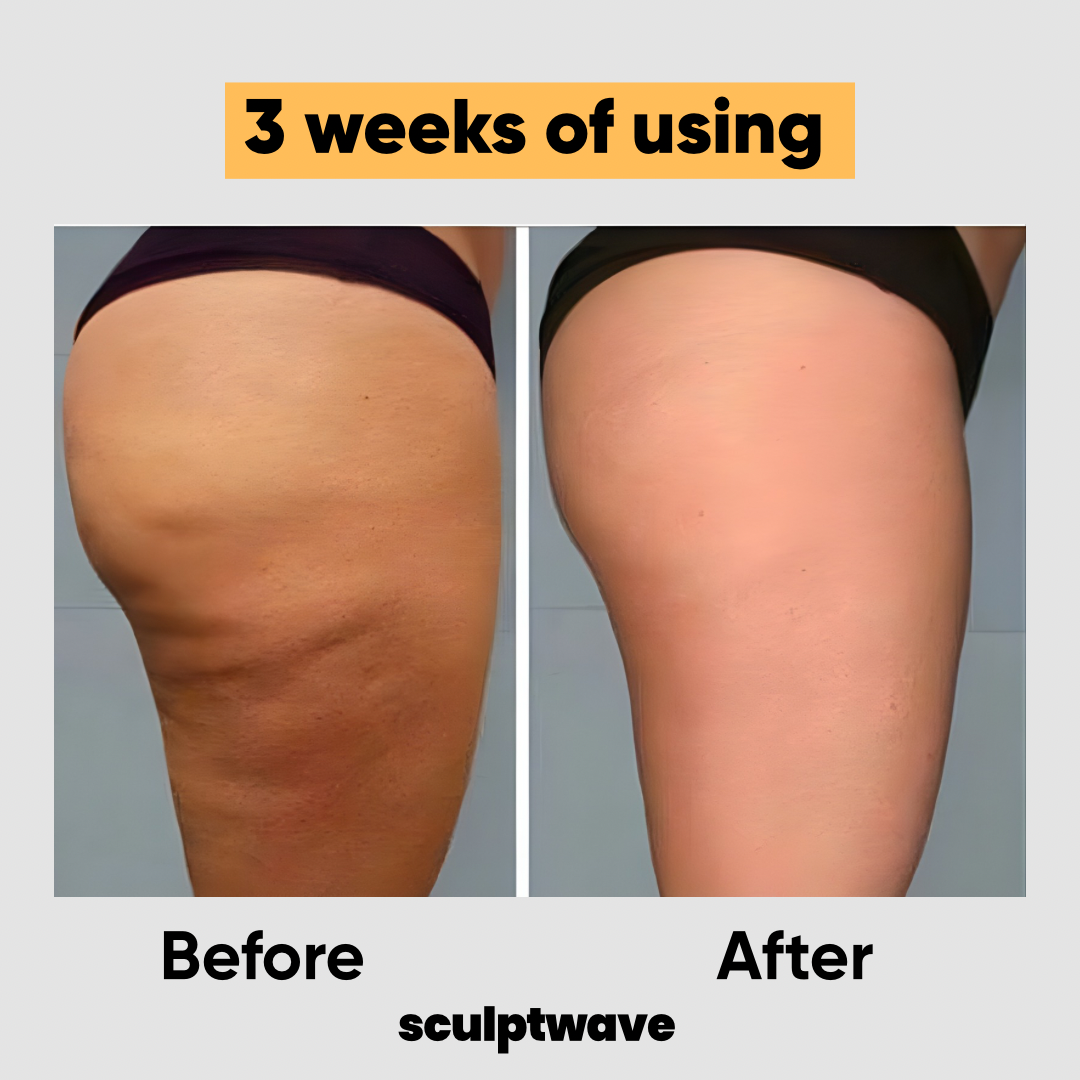 SculptWave™ Cellulite Eraser